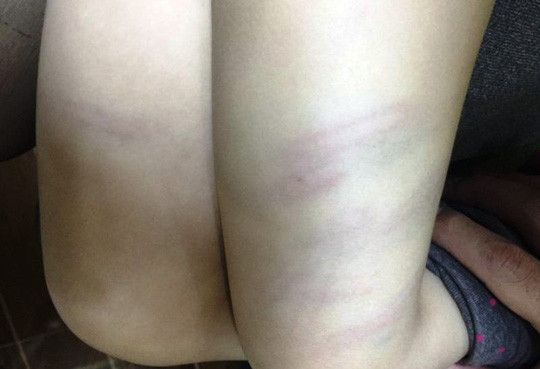 be 3 tuoi bi co giao mam non danh tham dui 1.jpg