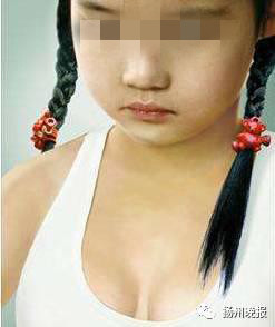 me nga ngua khi biet ly do con gai 6 tuoi day thi som nguc phat trien bat thuong 1.jpg