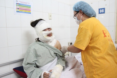 bac si noi gi ve loai bong gay tai nan nat mat thuong xay ra o nhung cuoc vui img_7049.jpg
