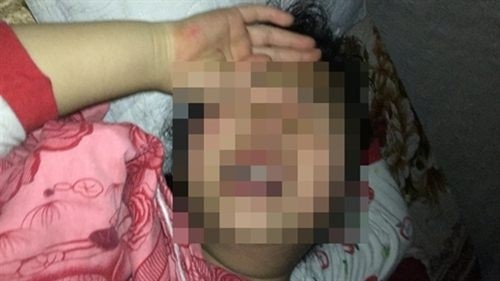 be 8 tuoi o hoang mai bi xam hai van hoang loan moi dem 2.jpg