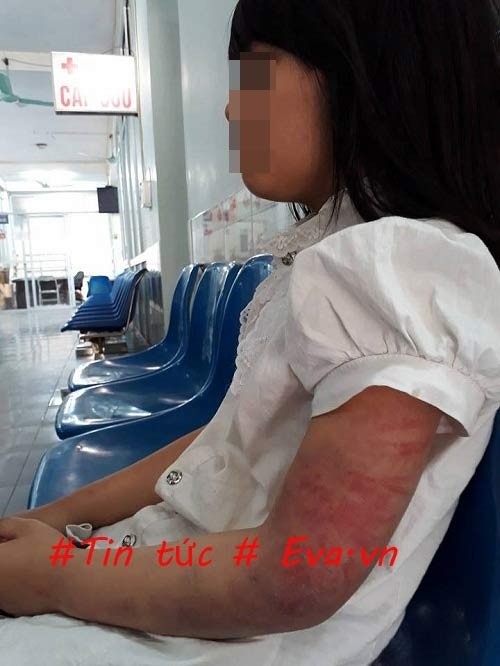 phan no nguoi cha dung gay danh tham tim co the con gai 10 tuoi 4.jpg