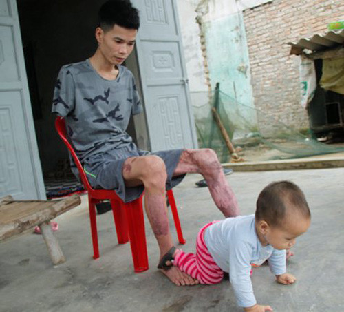 gia canh dang thuong cua nguoi bo tre cut hai tay mot minh nuoi con tho khat sua 3.jpg