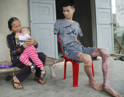 gia canh dang thuong cua nguoi bo tre cut hai tay mot minh nuoi con tho khat sua 4.jpg