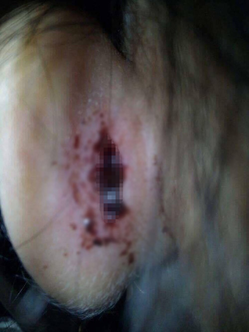 be 4 tuoi chay mau tai do co giao mam nonquet tay 6.jpg