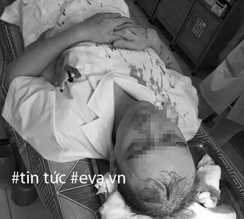 ha noi bac si bi nguoi nha benh nhan danh hung bat tinh chan thuong so nao 8.jpg