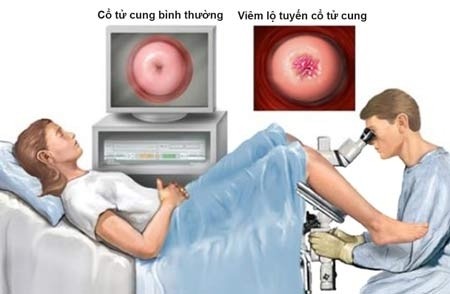 1492409934 tu cung.jpg