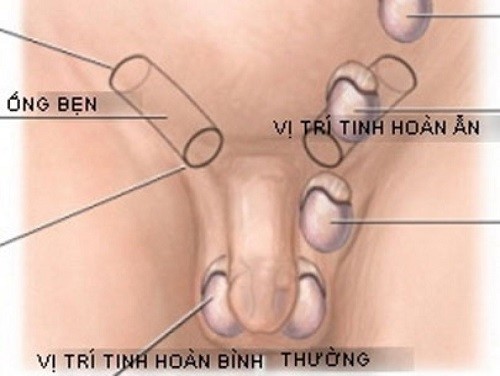 1492659091 tinh hoan an.jpg