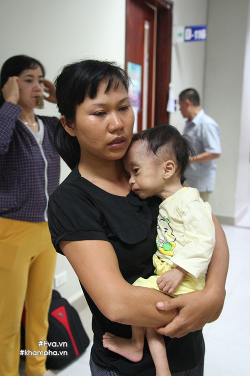 xot-xa-em-be-sinh-ra-nang-4kg-sau-mot-nam-chi-con-34kg-vi-khoi-u-quai-ac-khoi-u9.jpg