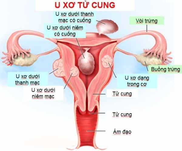 u xo tu cung