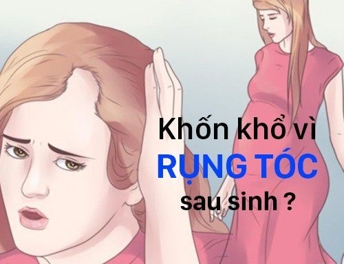 rung toc5