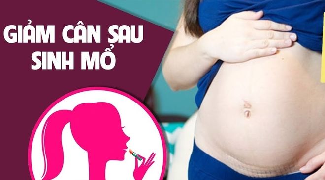 lay lai voc dang sau sinh mo