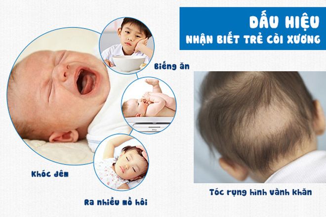 be 8 thang chua moc rang