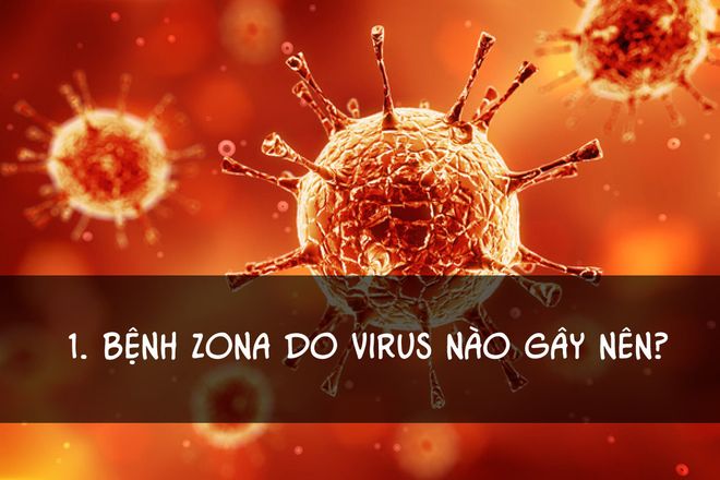 virus gây zona