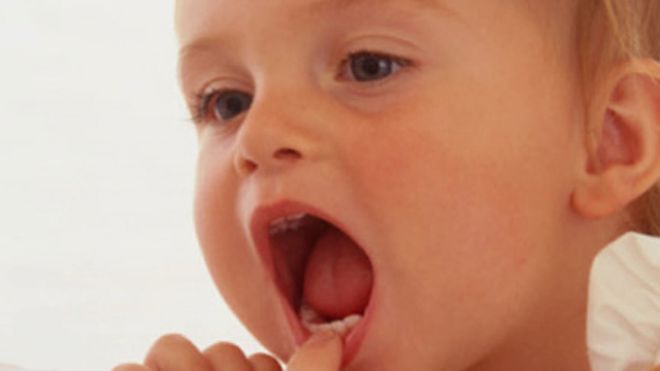 bé bị lở miệng