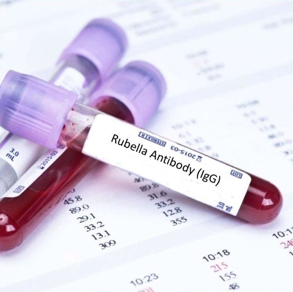 Xét nghiệm rubella trước khi mang thai để đảm bảo sức khỏe của bạn