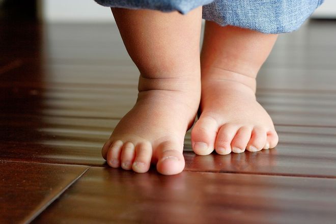 bé tập đi chân vòng kiềng