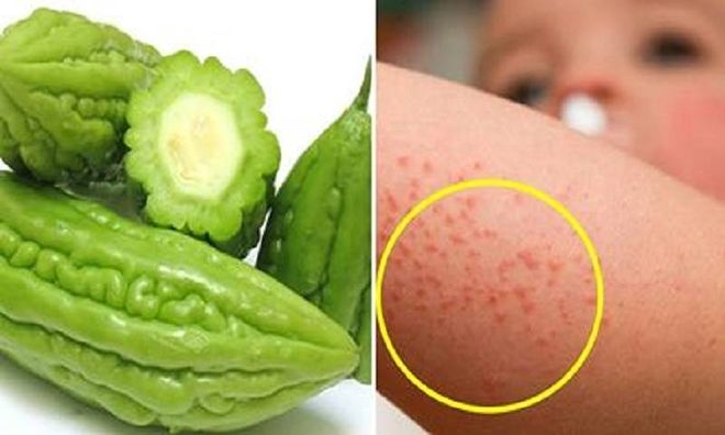 mướp đắng trị rôm sảy