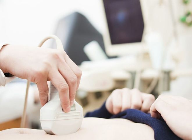 đi siêu âm để canh rụng trứng