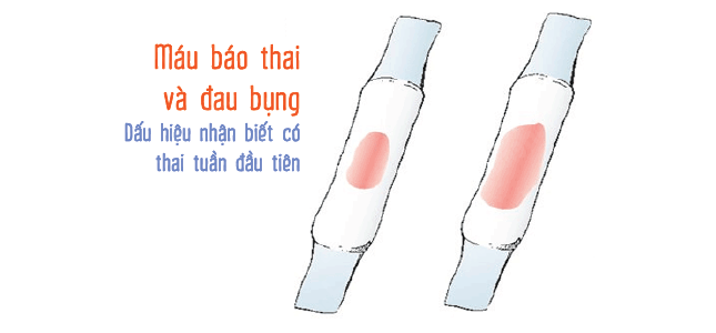 máu báo có thai