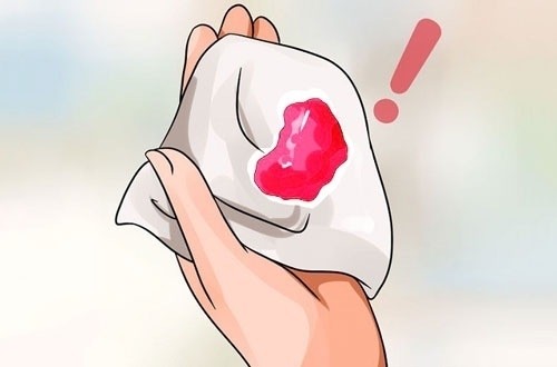 máu báo hay máu kinh nguyệt