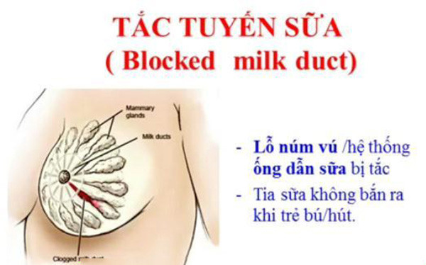 cấu tạo tuyến sữa