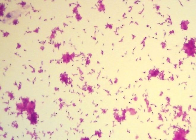 vi khuẩn clostridium tetani