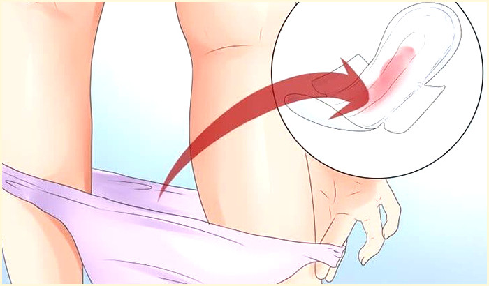 Chảy máu âm đạo bất thường
