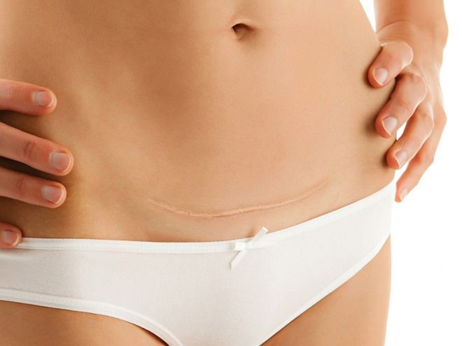 có quá nhiều nguy cơ xấu tiềm ẩn cho lần mang thai và vượt cạn kế tiếp