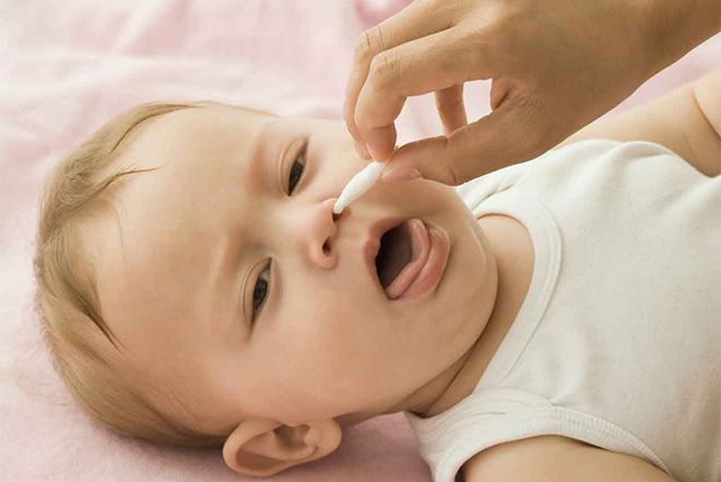 bé 4 tháng bị sổ mũi do ngạt mũi sơ sinh
