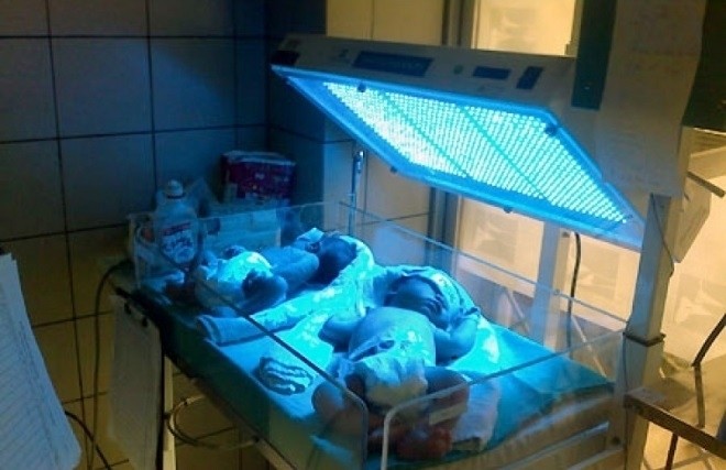 chiếu đèn điều trị cho bé bị vàng da
