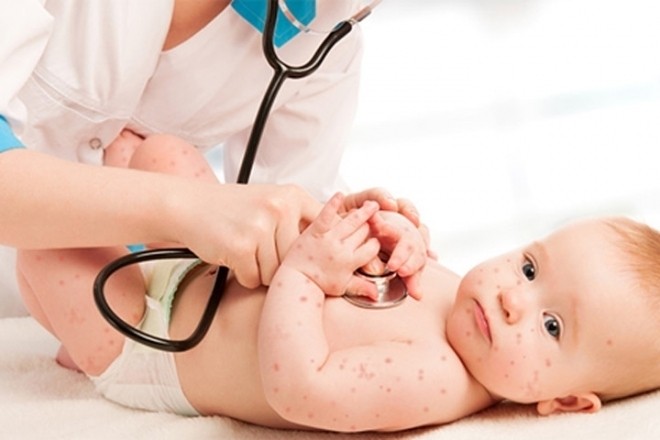 bé bị bệnh tay chân miệng nặng phải đưa đến bệnh viện