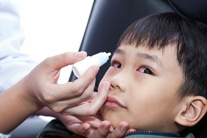Trẻ bị viêm kết mạc mắt cần sử dụng thước theo chỉ định của bác sĩ