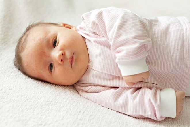 nên đưa trẻ đi khám bác sĩ nếu trẻ không phản ứng với âm thanh lớn