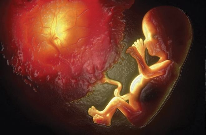 Nước ối có màu xanh đục