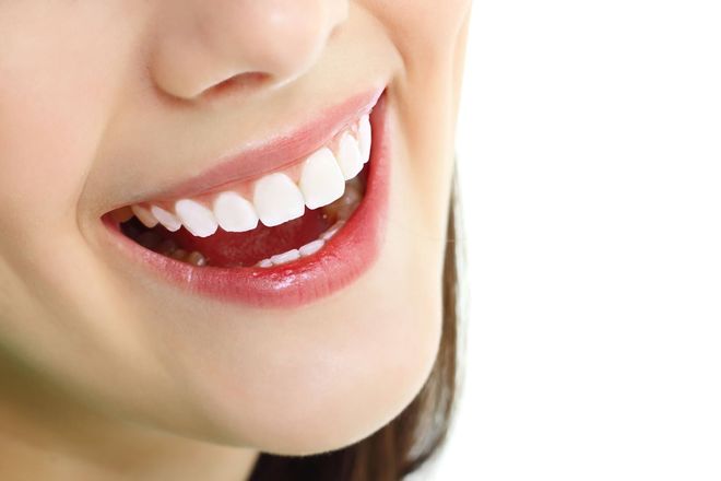 hạn chế uống nước chnh khi răng đau buốt