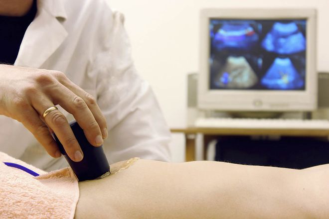 Siêu âm thai là bước cuối cùng của quy trình thụ tinh nhân tạo IVF