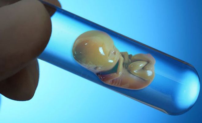 Tại Việt Nam, quy trình thụ tinh nhân tạo IVF bắt đầu được thực hiện vào năm 1997.