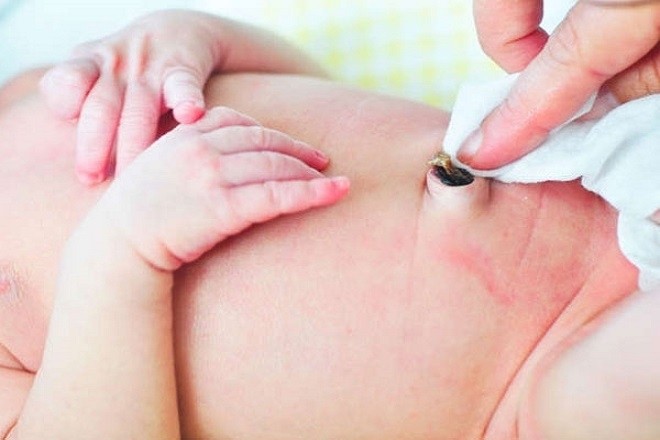 vệ sinh và giữ rốn bé sạch sẽ