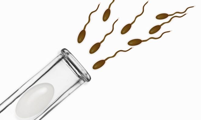 Thụ tinh trong ống nghiệm (IVF)