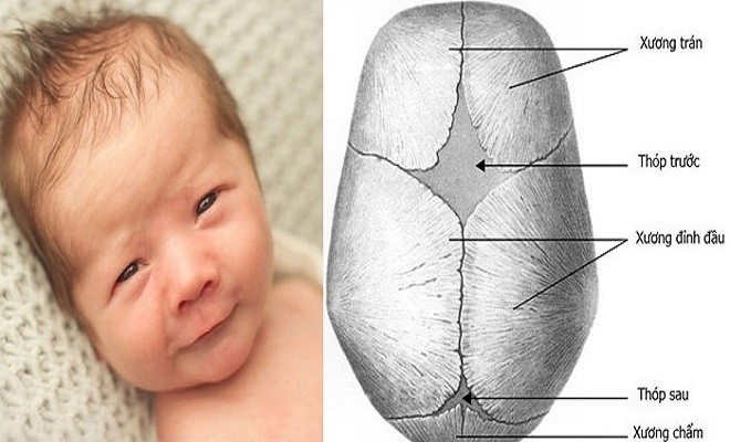 cấu tạo vùng xương sọ của trẻ sơ sinh