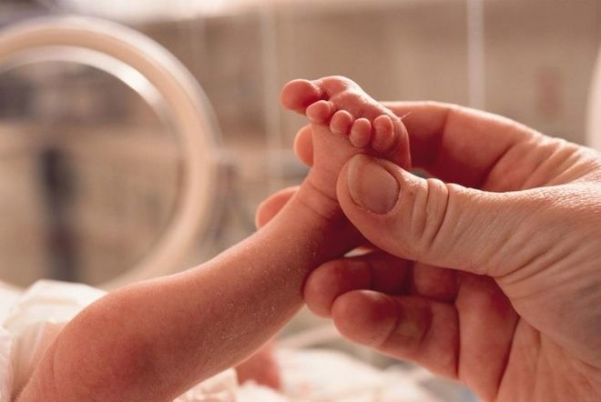 Biến chứng dễ gặp phải của cặp sinh đôi