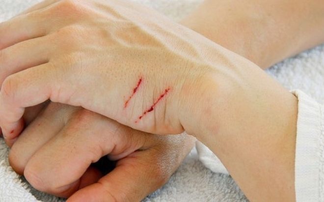 uốn ván xâm nhập vào da