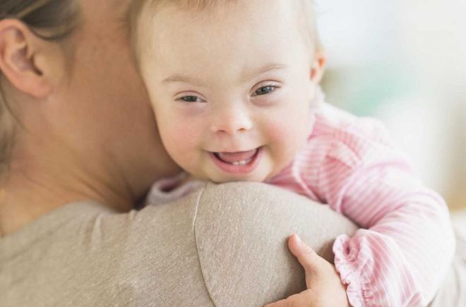 nguy cơ mắc hội chứng Down ở trẻ cũng tăng lên khi mẹ càng lớn tuổi.