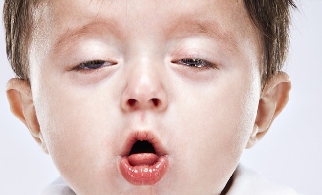 bé ho nhiều khò khè do viêm tiểu phế quản