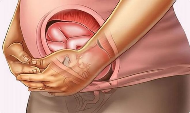 Không phải trường hợp thụ tinh ống nghiệm nào cũng sinh song thai hoặc đa thai.