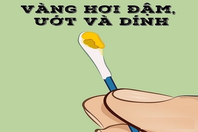 ráy tai của trẻ sơ sinh