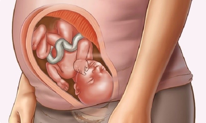 Thai nhi 30 tuần bé thường xuyên đạp hoặc nhào lộn