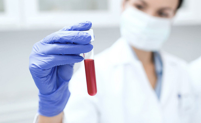 Xét nghiệm máu HCG xác định thai ngoài tử cung
