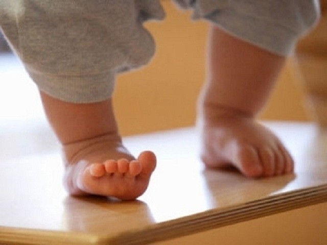 chân vòng kiềng sẽ khiến bé đi hai hàng