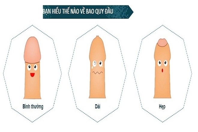 có nên cắt bao quy đầu cho trẻ sơ sinh